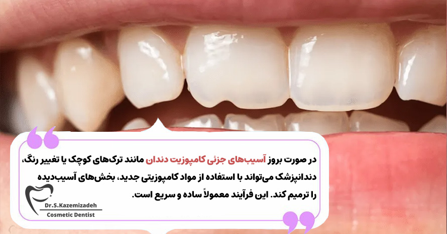 آیا کامپوزیت دندان قابل‌ترمیم است؟ | دکتر سپیده کاظمی زاده در اصفهان