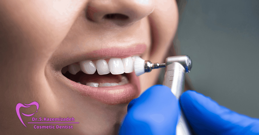 آیا میتوانید از مسواک برقی روی لمینت دندان استفاده کنید؟ | دکتر سپیده کاظمی زاده