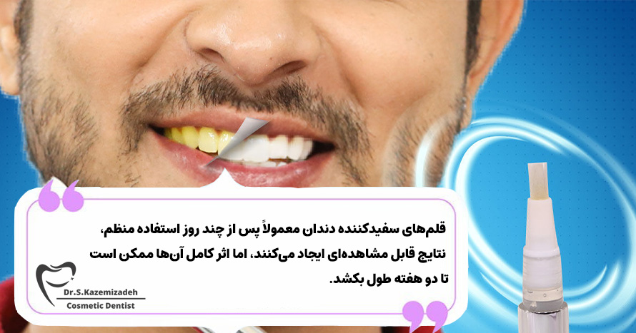 قلم‌های سفیدکننده دندان چقدر سریع کار می‌کنند؟ | دکتر سپیده کاظمی زاده