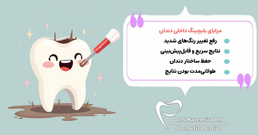 مزایای بلیچینگ داخلی دندان
