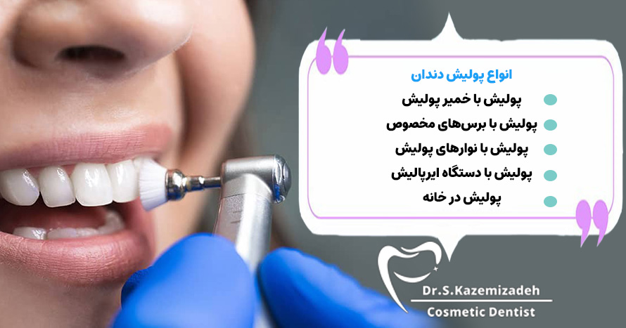 انواع پولیش دندان: روشی برای حفظ زیبایی و سلامت دندان‌ها | دکتر سپیده کاظمی زاده