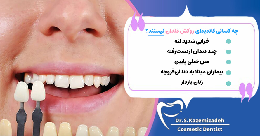 چه کسانی کاندیدای روکش دندان نیستند؟ | دکتر سپیده کاظمی زاده در اصفهان