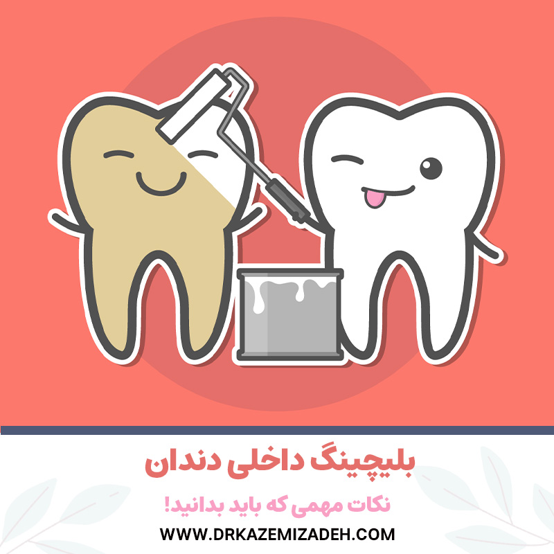 بلیچینگ داخلی دندان | نکات مهمی که باید بدانید! | دکتر سپیده کاظمی زاده