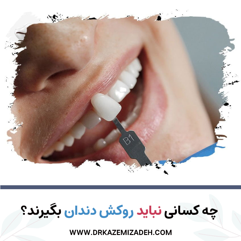 چه کسانی نباید روکش دندان بگیرند؟ | دکتر سپیده کاظمی زاده