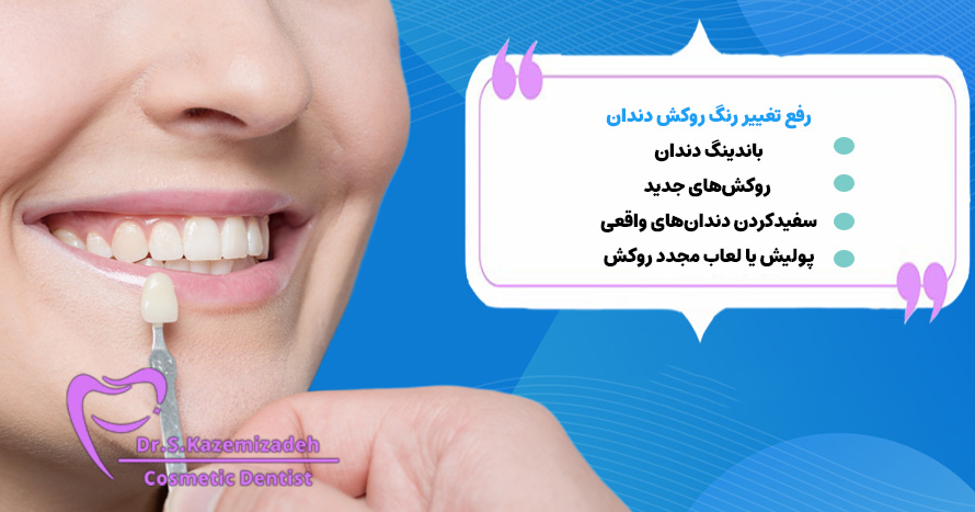 رفع تغییر رنگ روکش دندان | دکتر سپیده کاظمی زاده در اصفهان