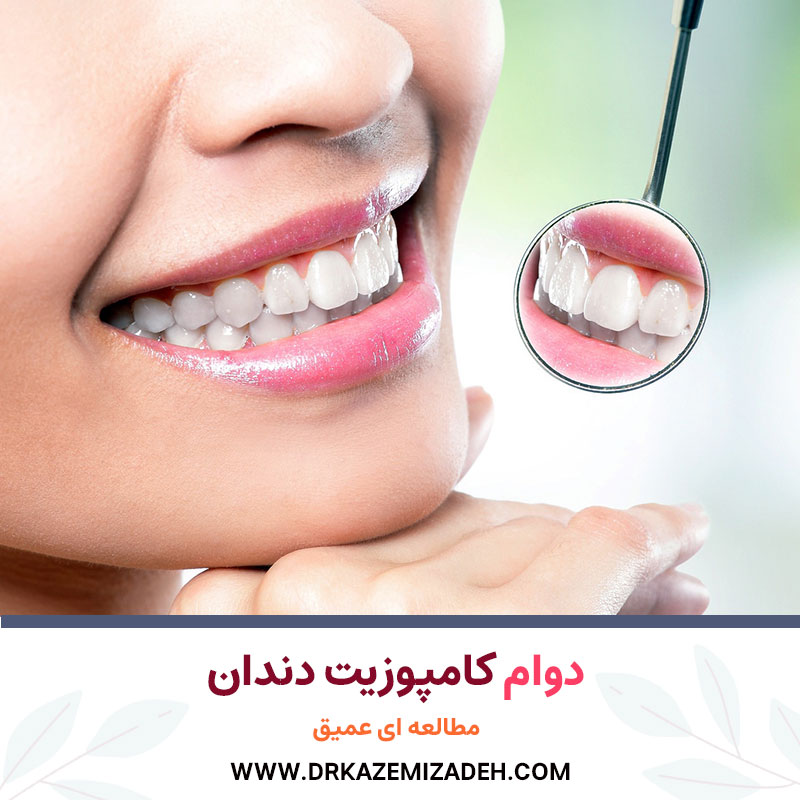 دوام کامپوزیت دندان: یک مطالعه عمیق | دکتر سپیده کاظمی زاده در اصفهان