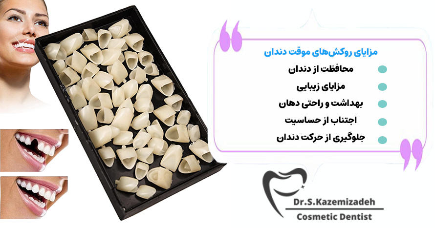 مزایای روکشهای موقت دندان | دکتر سپیده کاظمی زاده در اصفهان