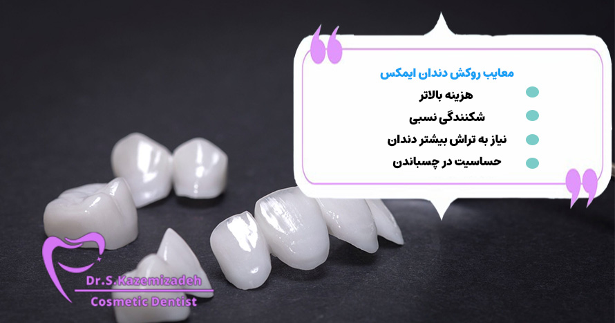 معایب روکش دندان ایمکس | دکتر سپیده کاظمی زاده