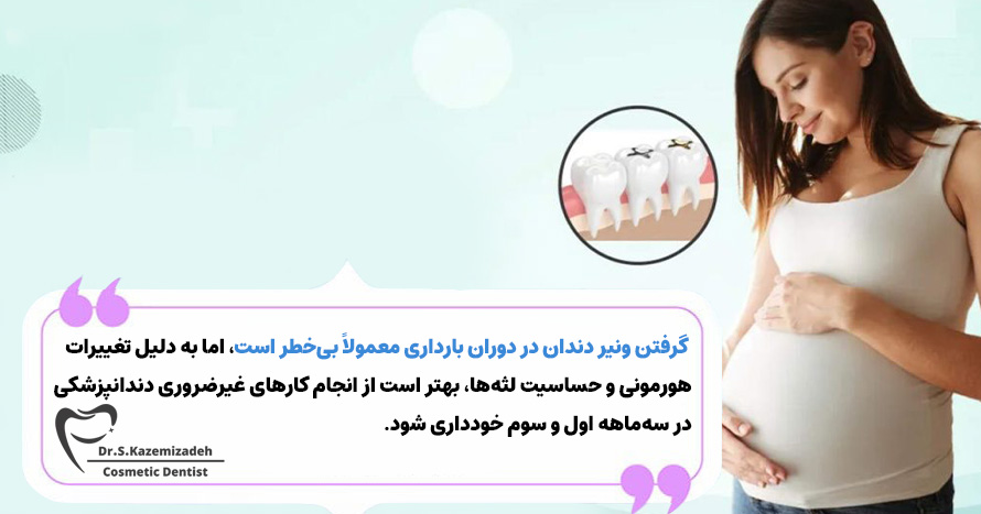آیا گرفتن ونیر در دوران بارداری بیخطر است؟ | دکتر سپیده کاظمی زاده در اصفهان