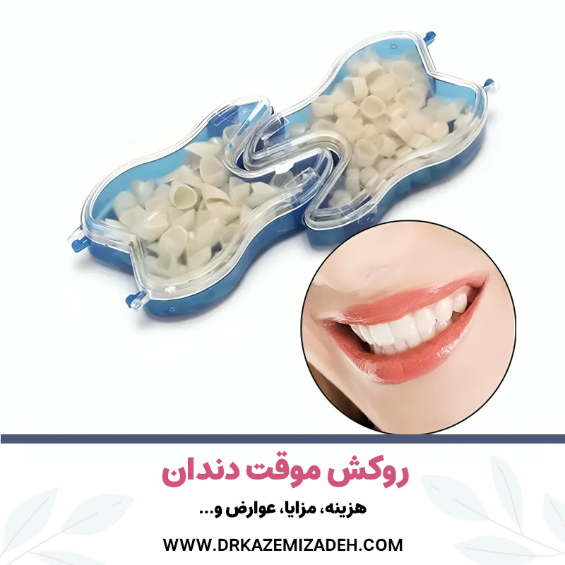 روکش موقت دندان | هزینه، مزایا، عوارض و... | دکتر سپیده کاظمی زاده در اصفهان