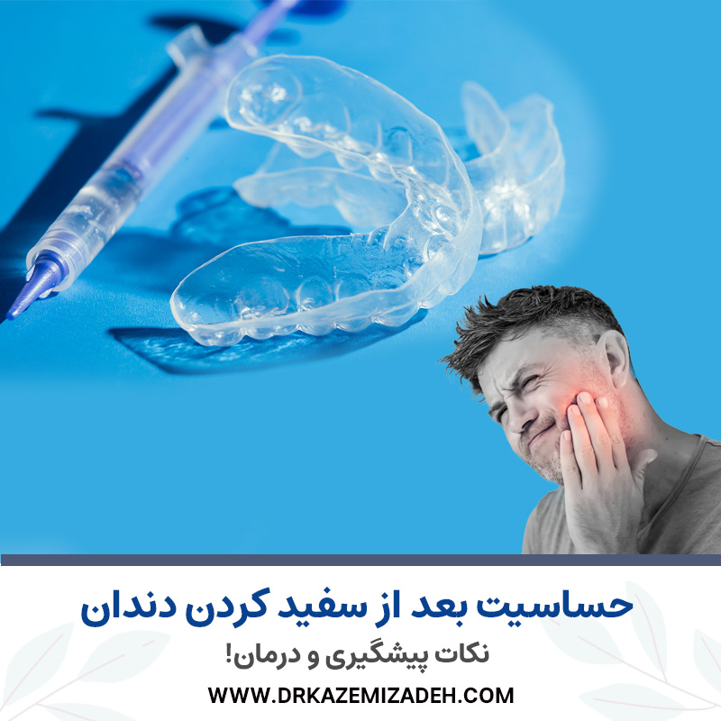 حساسیت بعد از سفید کردن دندان | نکات پیشگیری و درمان! | دکتر سپیده کاظمی زاده