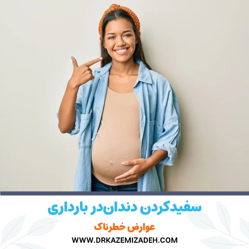 نظر متخصصان در مورد سفیدکردن دندان‌ها در دوران بارداری | دکتر سپیده کاظمی زاده در اصفهان