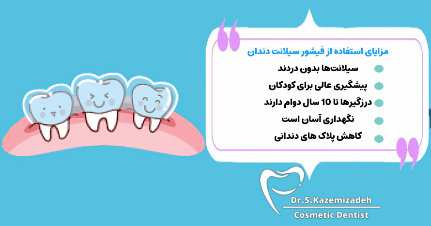 مزایای استفاده از فیشور سیلانت دندان | بهترین دندانپزشک زیبایی اصفهان 