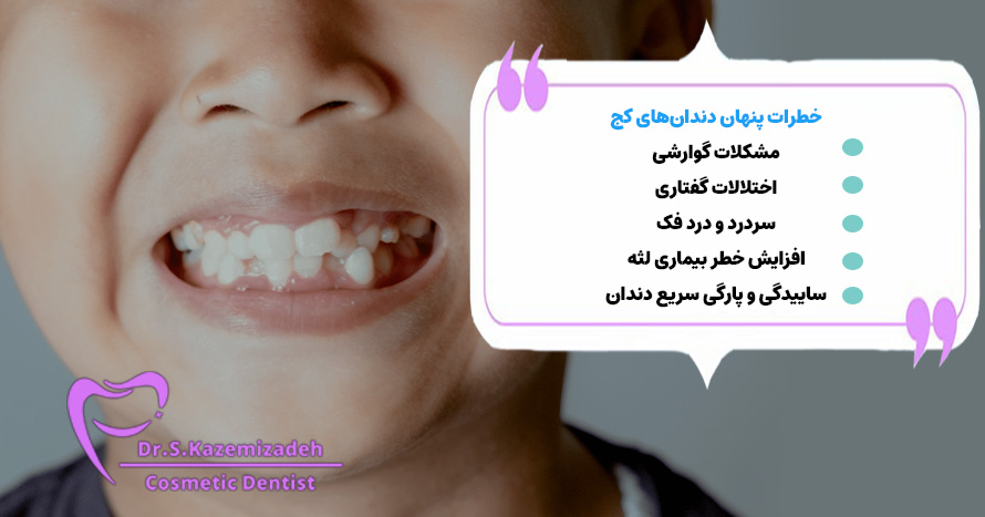 خطرات پنهان دندان‌های کج | مطب دکتر سپیده کاظمی زاده در اصفهان