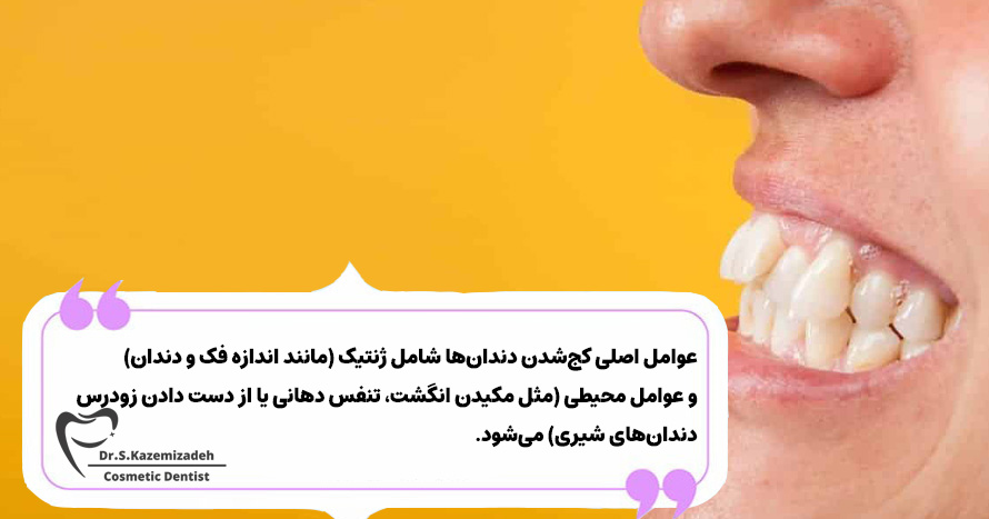 چه چیزی باعث کج‌شدن دندان‌ها می‌شود؟ | دکتر سپیده کاظمی زاده