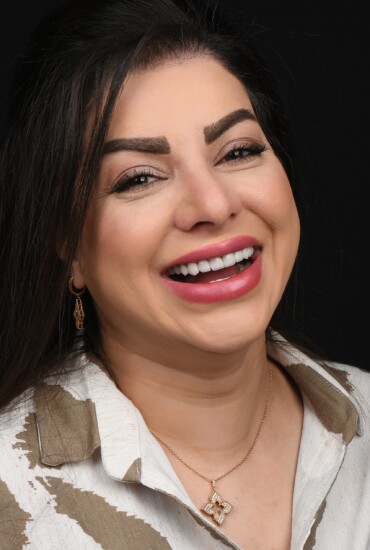 لمینیت سرامیکی در اصفهان در مرکز دندانپزشکی زیبایی دکتر سپیده کاظمی زاده